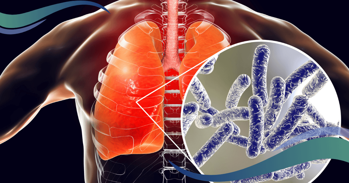 The image shows the human body's lungs with Legionella disease